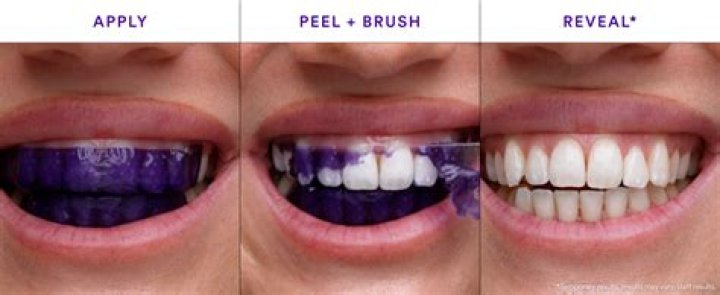 Erin Andrews Uses These At-Home Whitening Strips for the Perfect Smile